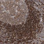 CEP85L Polyclonal Antibody