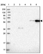 CEP85L Antibody in Western Blot (WB)
