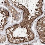 CEP85L Antibody in Immunohistochemistry (IHC)