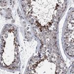 CEP85L Polyclonal Antibody