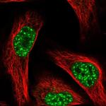 FBXL4 Polyclonal Antibody