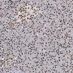FBXL4 Antibody in Immunohistochemistry (Paraffin) (IHC (P))