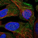 LYSMD4 Polyclonal Antibody