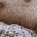 LYSMD4 Antibody in Immunohistochemistry (Paraffin) (IHC (P))