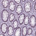 NOL7 Antibody in Immunohistochemistry (Paraffin) (IHC (P))