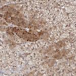 KLHL4 Polyclonal Antibody