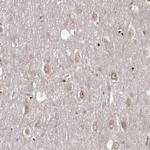 TBC1D25 Polyclonal Antibody