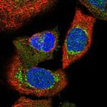 NUBPL Polyclonal Antibody