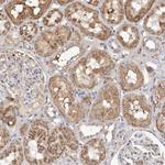 NUBPL Antibody in Immunohistochemistry (IHC)