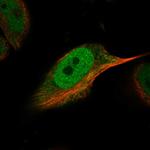 SNR48 Polyclonal Antibody