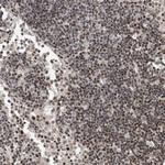 SNR48 Antibody in Immunohistochemistry (Paraffin) (IHC (P))