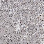 SNR48 Antibody in Immunohistochemistry (Paraffin) (IHC (P))
