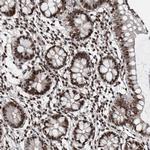 SNR48 Antibody in Immunohistochemistry (Paraffin) (IHC (P))