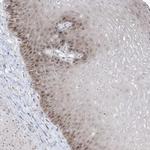 TSEN15 Antibody in Immunohistochemistry (Paraffin) (IHC (P))