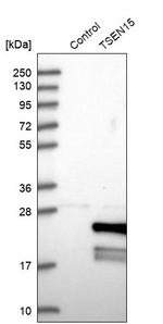 TSEN15 Antibody in Western Blot (WB)
