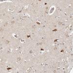 ZRANB1 Antibody in Immunohistochemistry (Paraffin) (IHC (P))