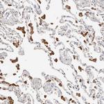ZRANB1 Antibody in Immunohistochemistry (Paraffin) (IHC (P))