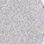 ZRANB1 Antibody in Immunohistochemistry (Paraffin) (IHC (P))
