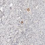 ZRANB1 Antibody in Immunohistochemistry (IHC)