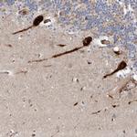 USF3 Polyclonal Antibody