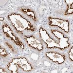 TMEM63B Polyclonal Antibody