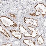 TMEM63B Antibody in Immunohistochemistry (Paraffin) (IHC (P))