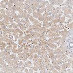 TMEM63B Antibody in Immunohistochemistry (Paraffin) (IHC (P))