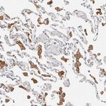 TMEM63B Antibody in Immunohistochemistry (Paraffin) (IHC (P))