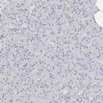 TMEM63B Antibody in Immunohistochemistry (Paraffin) (IHC (P))