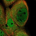 KIFC2 Polyclonal Antibody