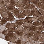 KIFC2 Antibody in Immunohistochemistry (Paraffin) (IHC (P))