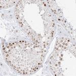 SPT5 Antibody in Immunohistochemistry (IHC)