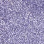 KIAA1751 Polyclonal Antibody
