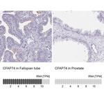 KIAA1751 Antibody in Immunohistochemistry (IHC)