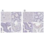 KIAA1751 Antibody in Immunohistochemistry (IHC)