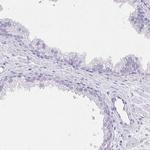 KIAA1751 Antibody in Immunohistochemistry (IHC)