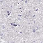 KIAA1751 Antibody in Immunohistochemistry (IHC)