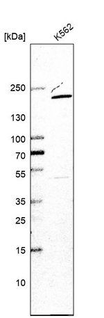 USP47 Antibody in Western Blot (WB)