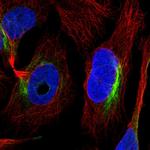 ZNF557 Polyclonal Antibody