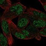 ZNF850 Polyclonal Antibody