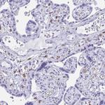 ZNF850 Antibody in Immunohistochemistry (Paraffin) (IHC (P))