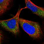 TTC38 Polyclonal Antibody