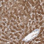 TTC38 Antibody in Immunohistochemistry (Paraffin) (IHC (P))