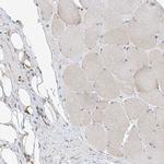 TTC38 Antibody in Immunohistochemistry (Paraffin) (IHC (P))