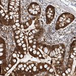 TTC38 Antibody in Immunohistochemistry (Paraffin) (IHC (P))