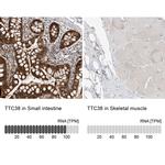 TTC38 Antibody