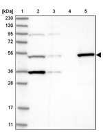 TTC38 Antibody in Western Blot (WB)