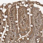 SDCCAG3 Polyclonal Antibody