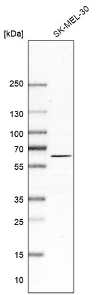Asparagine Synthetase Antibody in Western Blot (WB)