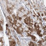 Asparagine Synthetase Antibody in Immunohistochemistry (IHC)